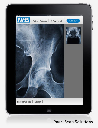 x rayscanning app prototype